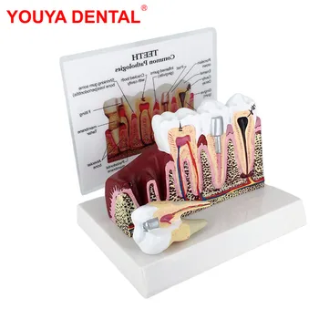 Напълно Анатомическая Модел На Зъбите За Проучване На Обучение Демонстрация На Зъболекар Модели На Зъбите За Обучение На Пациенти На Стоматологични Продукти